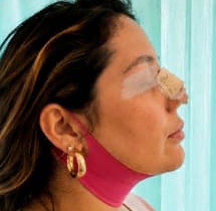 Inicio de la recuperación
