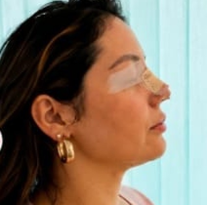 Disminución de la inflamación