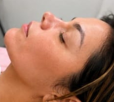Contorno facial más definido